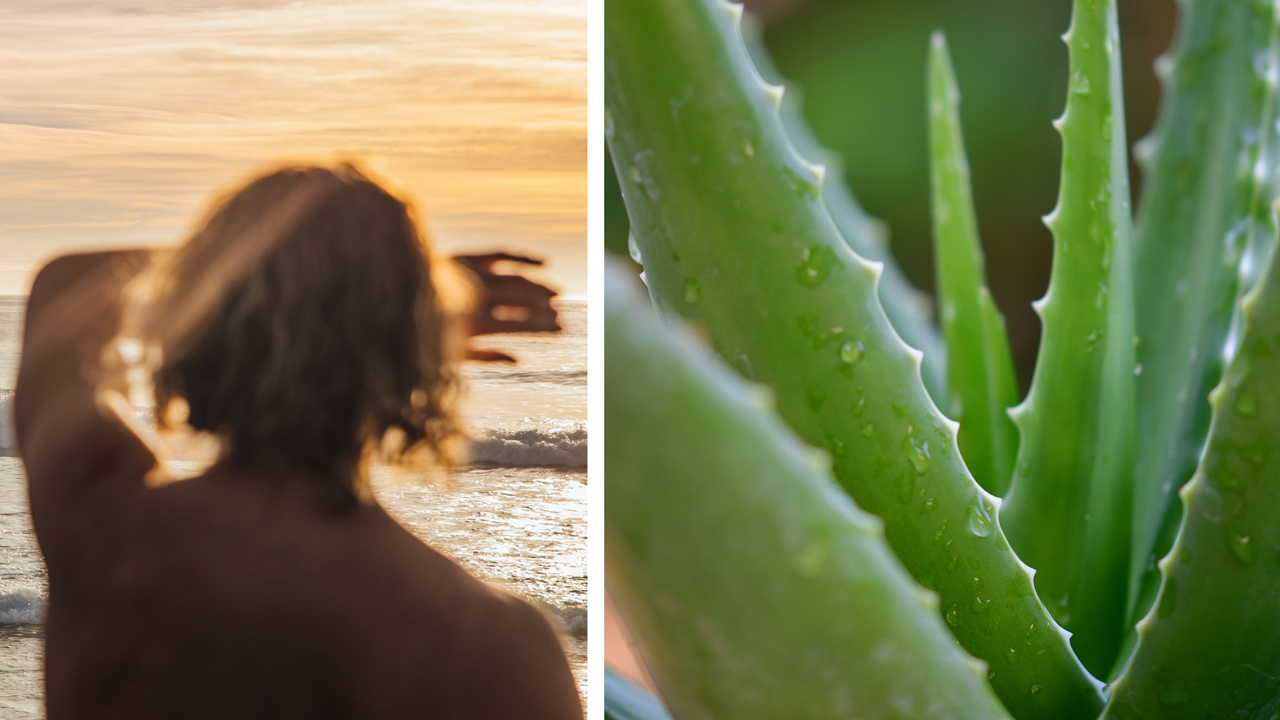 Sunburn Home Remedies 3 Natural Treatment Methods Utopia