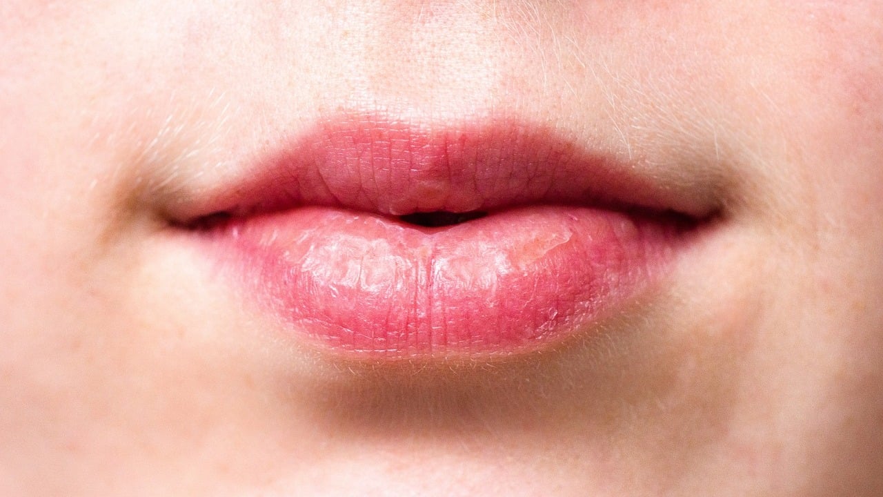 How to Naturally Fix Chapped Lips Fast Utopia